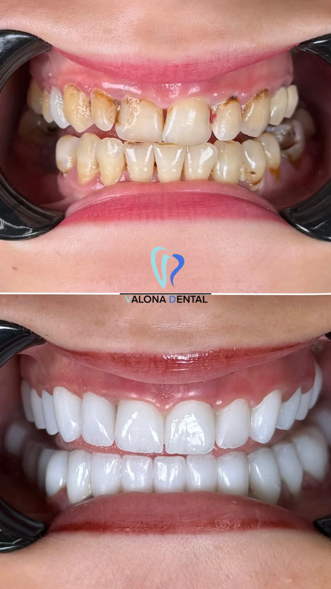 Before and after dental treatment 3