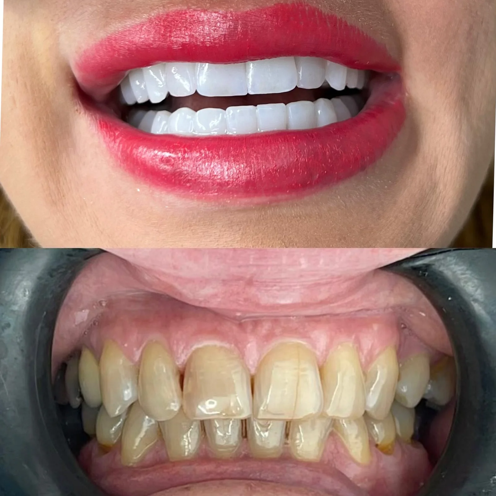 Before and after dental treatment 5