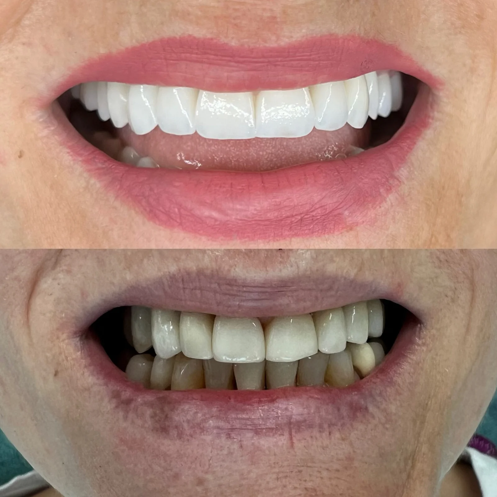 Before and after dental treatment 6